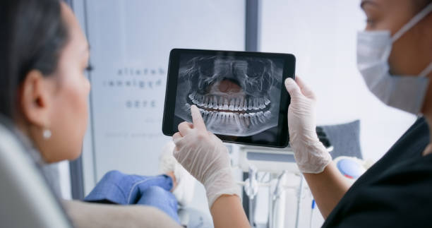 Licensed Tooth Extraction service in San Clemente, CA - Smile Center Dentistry
